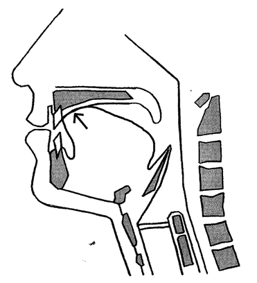 Tr�ning af tungen - Aarhus Universitetshospital